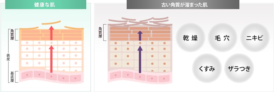 健康な肌と古い角質が溜まった肌