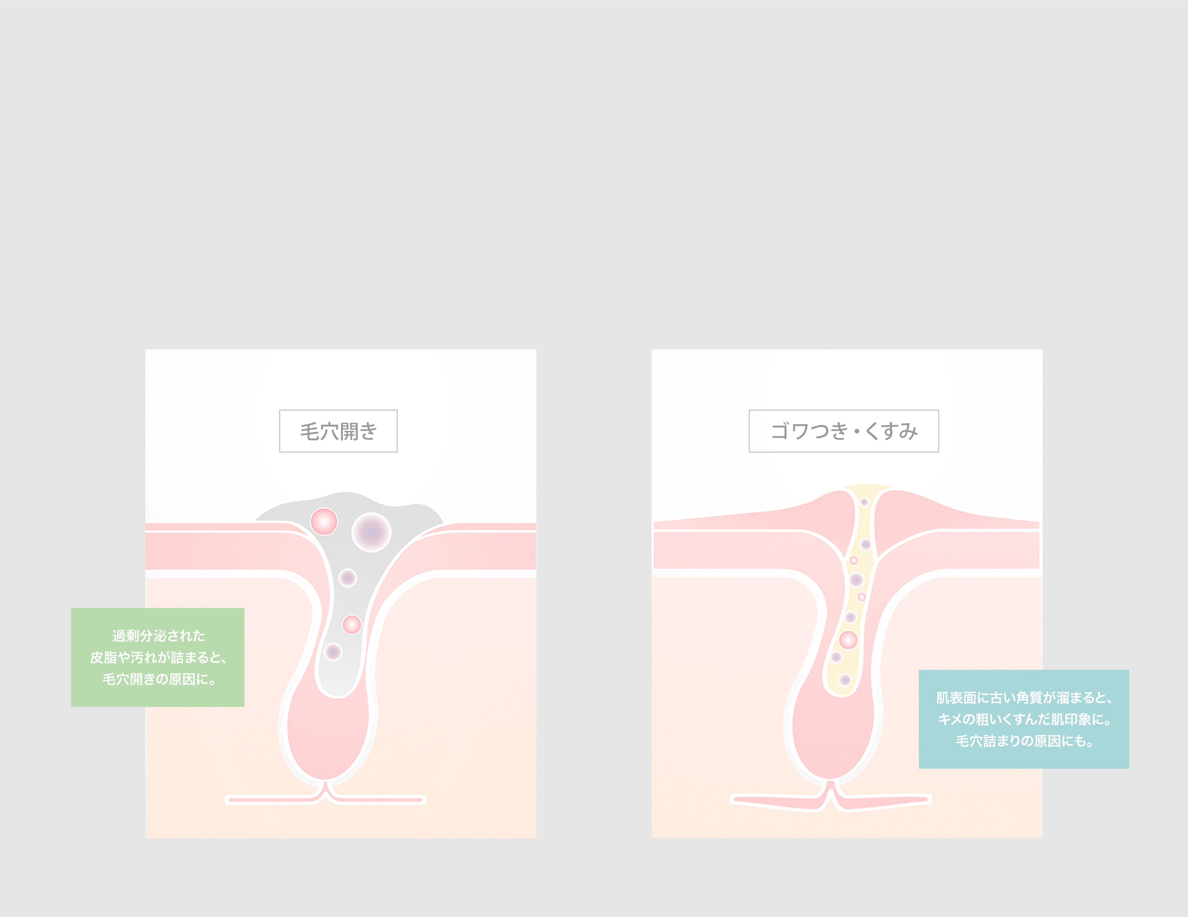 肌トラブルはなぜ起きる？