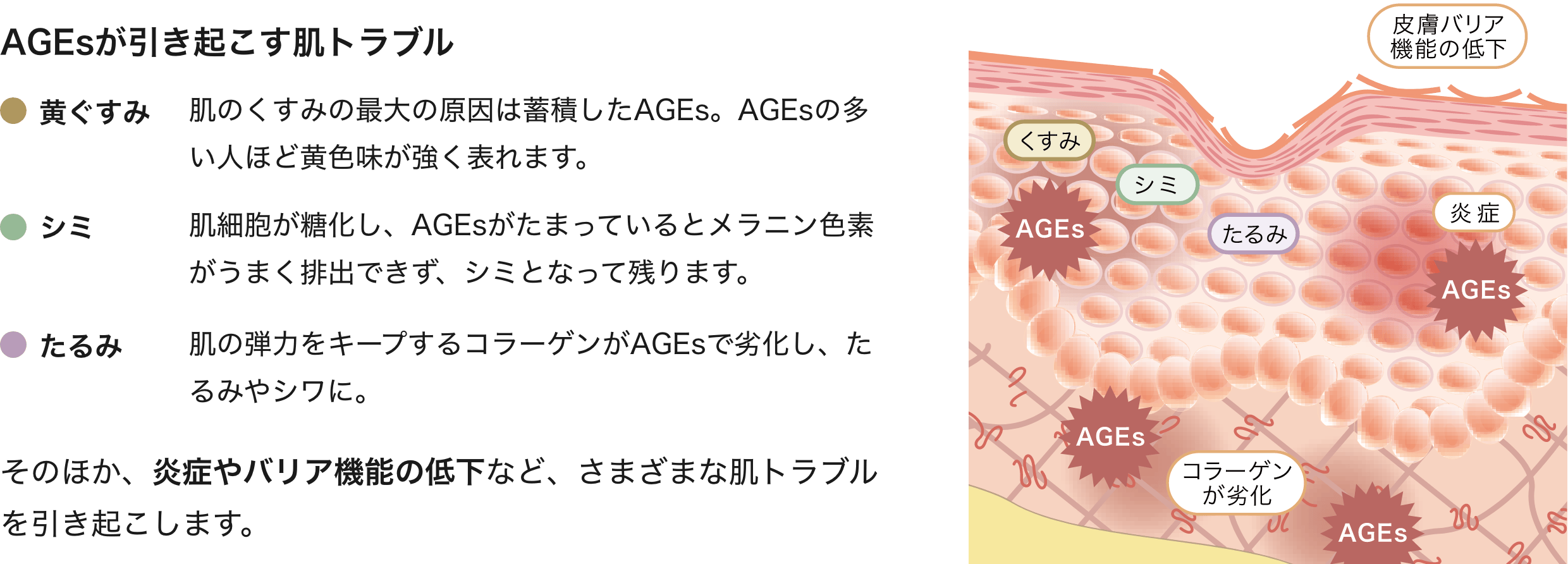 AGEsが引き起こす肌トラブル 黄ぐすみ 肌のくすみの最大の原因は蓄積したAGEs。AGEsの多い人ほど黄色味が強く表れます。シミ 肌細胞が糖化し、AGEsがたまっているとメラニン色素がうまく排出できず、シミとなって残ります。たるみ 肌の弾力をキープするコラーゲンがAGEsで劣化し、たるみやシワに。 そのほか、炎症やバリア機能の低下など、さまざまな肌トラブルを引き起こします。