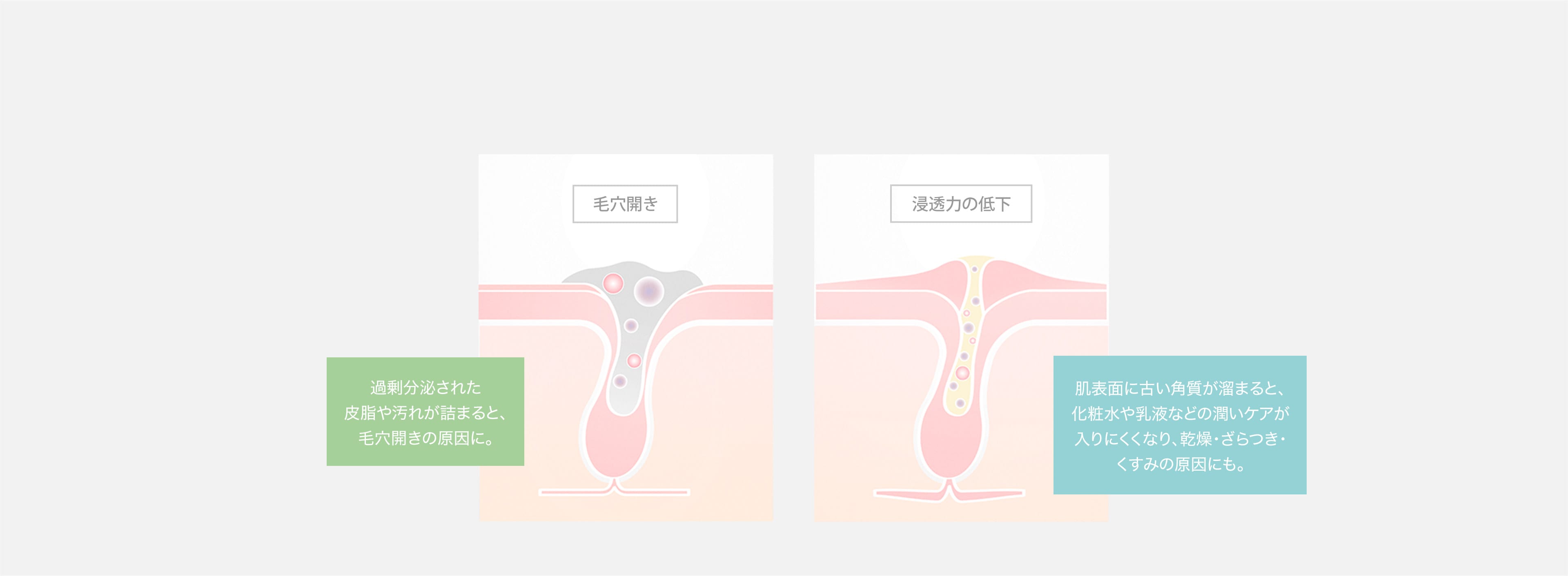 肌トラブルはなぜ起きる？